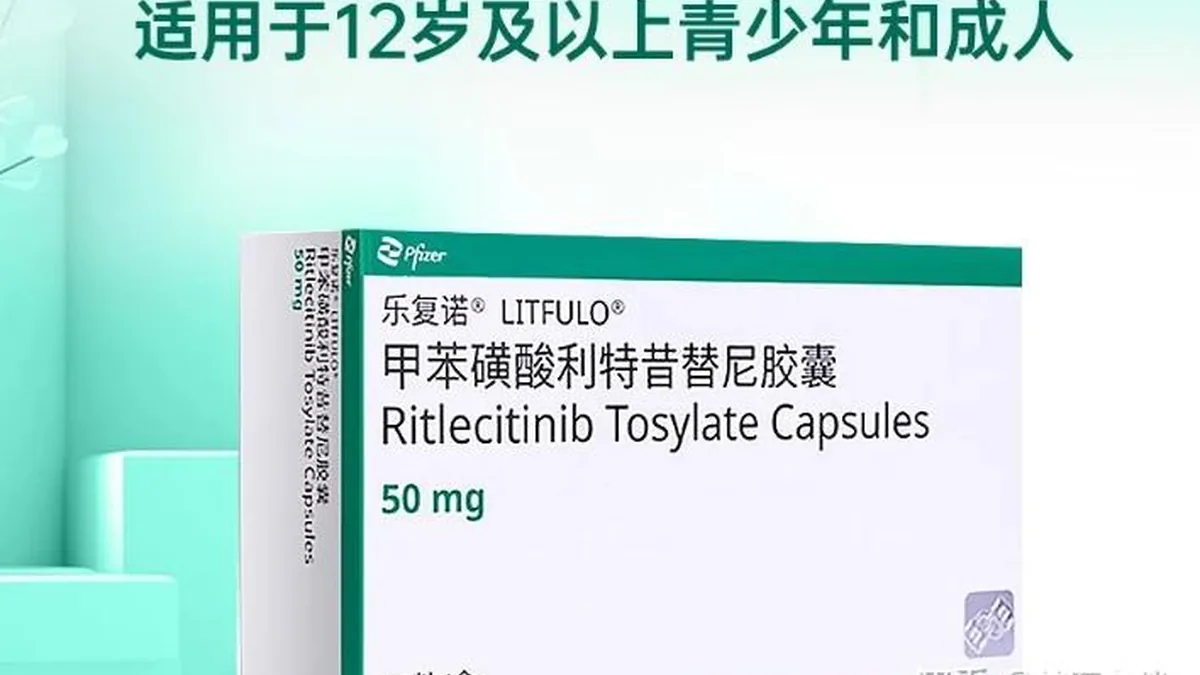 医生正在为斑秃患者解读用药前检查报告